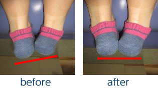 治療前→治療後