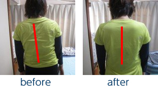 治療前→治療後