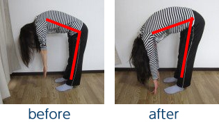 治療前→治療後